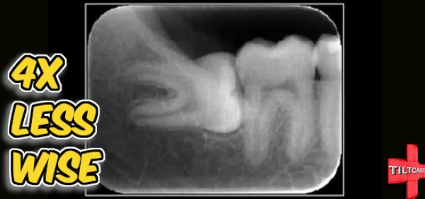 S16 EP 630 4X Less Wise